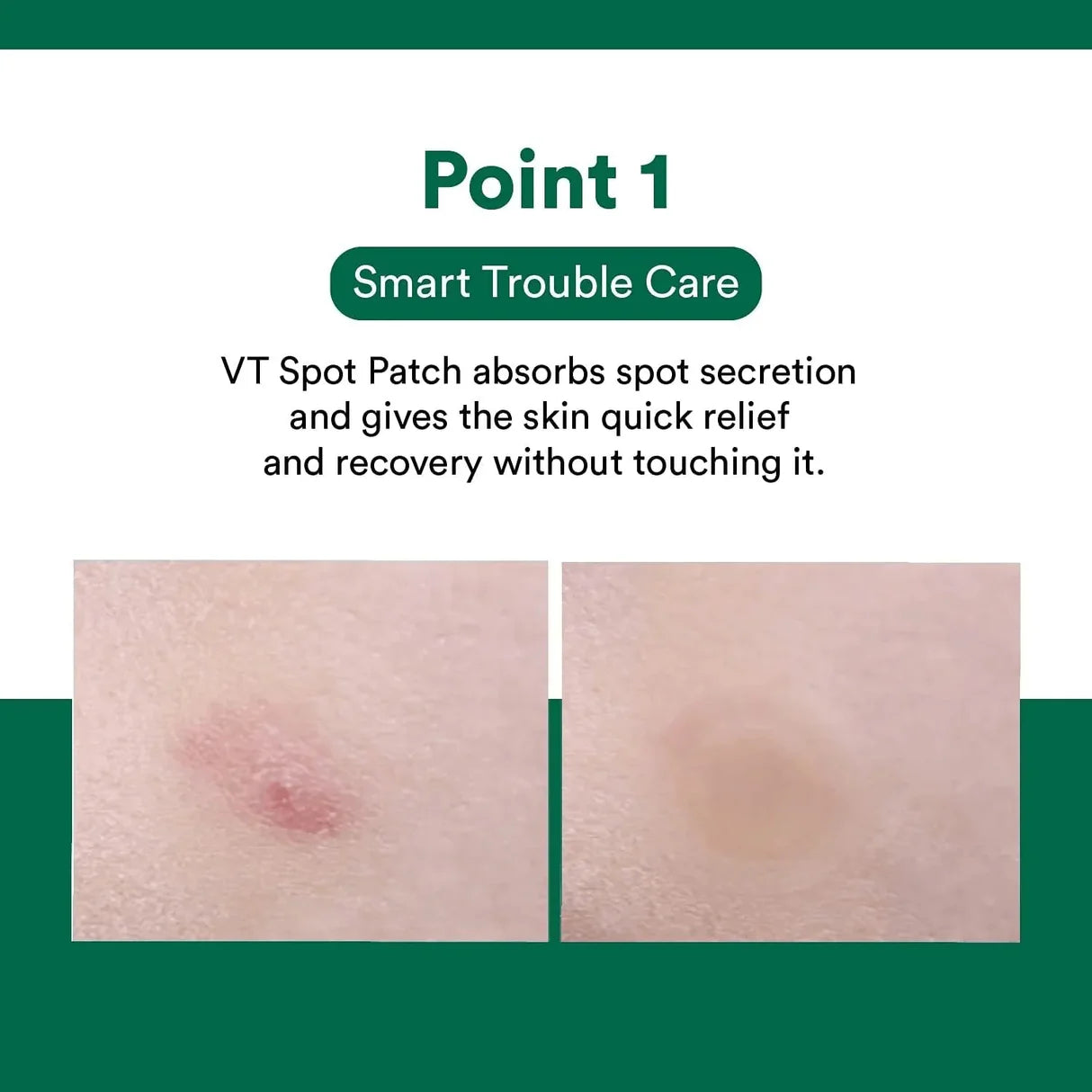 VT COSMETICS | Spot Patch