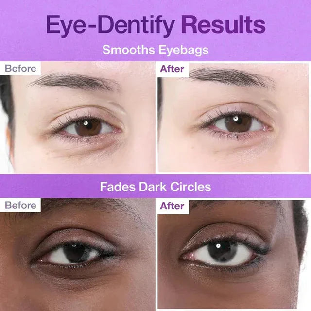 NUMBUZIN | NO.9 NAD COLLAGEN UNDER EYE PATCHES (5EA)
